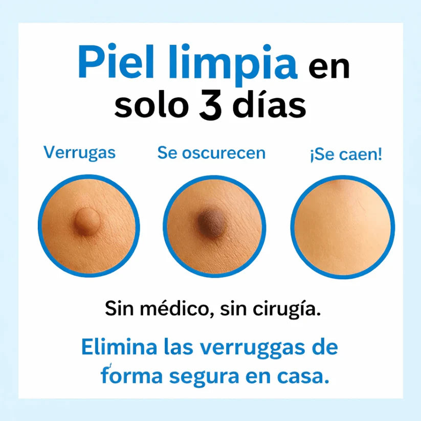 DermaSkin Plus™ – Elimina las Verrugas en Días, Sin Dolor