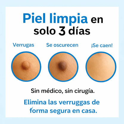 DermaSkin Plus™ – Elimina las Verrugas en Días, Sin Dolor
