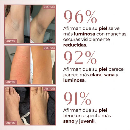 Kojilux™ – Spray Exfoliante con Ácido Kójico 99% – Elimina Manchas y Zonas Oscuras