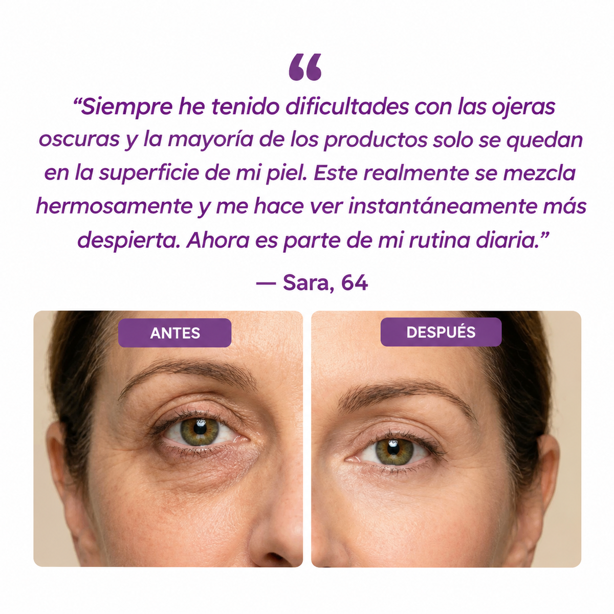 OjoCorrect™—Elimina Ojeras, Bolsas y Líneas Finas