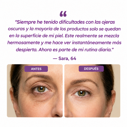 OjoCorrect™—Elimina Ojeras, Bolsas y Líneas Finas