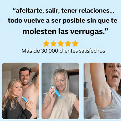 DermaSkin Plus™ – Elimina las Verrugas en Días, Sin Dolor