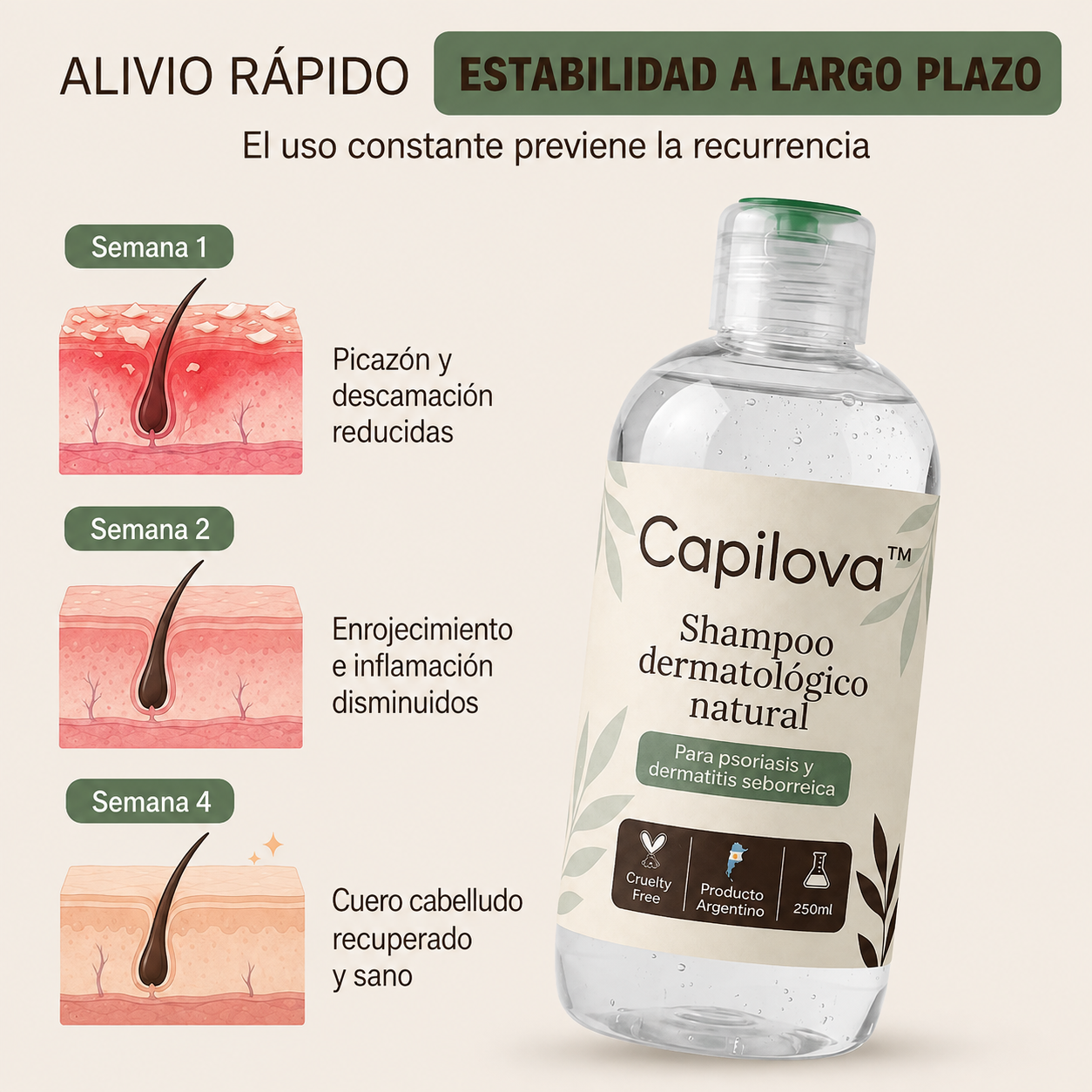 Capilova™ | Champú para la Caspa, Psoriasis Capilar y Dermatitis Seborreica
