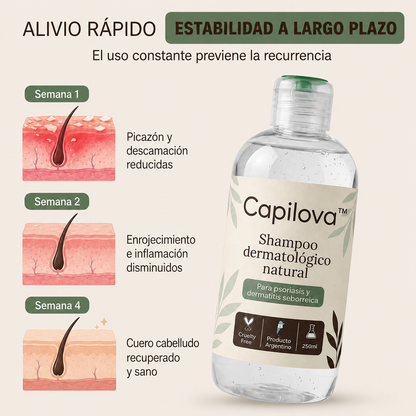 Capilova™ | Champú para la Caspa, Psoriasis Capilar y Dermatitis Seborreica