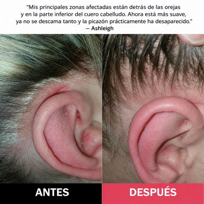 Capilux™ — Exfoliante para un Cuero Cabelludo Limpio y Calmado