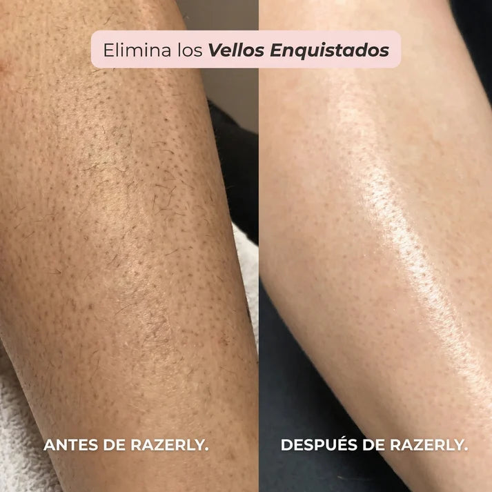 Silkéa™ – Piel Suave. Cero Cortes. Cero Irritación