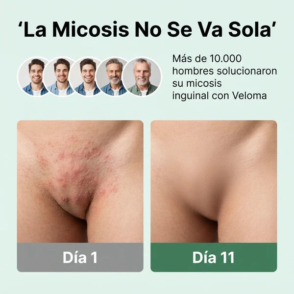 Veloma™–Acaba con el hongo desde la raíz
