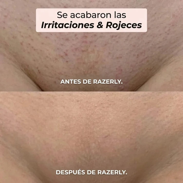 Silkéa™ – Piel Suave. Cero Cortes. Cero Irritación