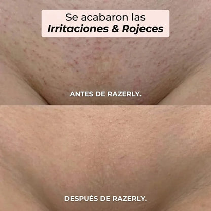 Silkéa™ – Piel Suave. Cero Cortes. Cero Irritación