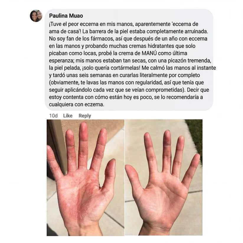 Crema natural MANÚ™ Anti Eczema 100g