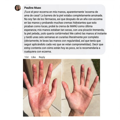 Crema natural MANÚ™ Anti Eczema 100g