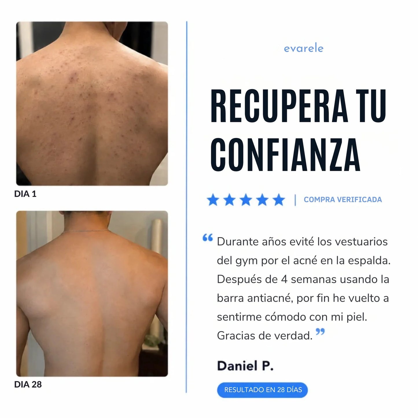 Bacnova™ Barra Antiacné