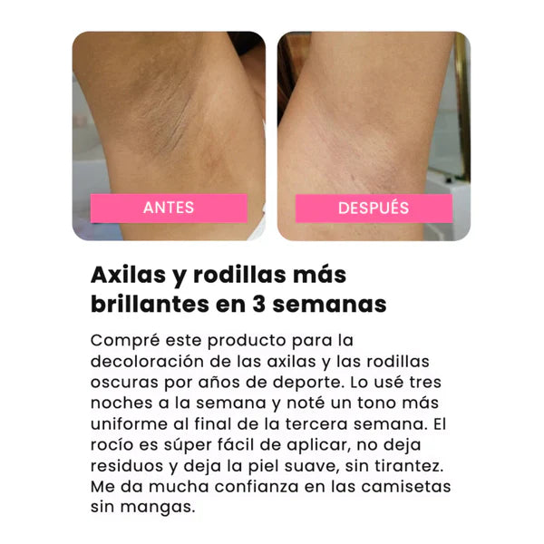 Kojilux™ – Spray Exfoliante con Ácido Kójico 99% – Elimina Manchas y Zonas Oscuras
