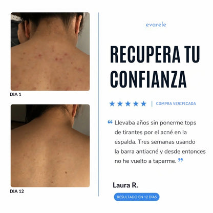 Bacnova™ Barra Antiacné