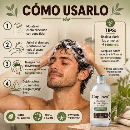 Capilova™ | Champú para la Caspa, Psoriasis Capilar y Dermatitis Seborreica
