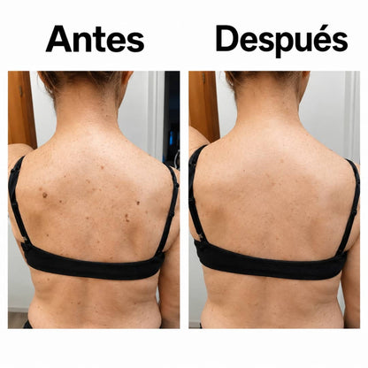 PielLisa™—Adiós a la Piel Áspera: Exfolia, Alisa y Unifica