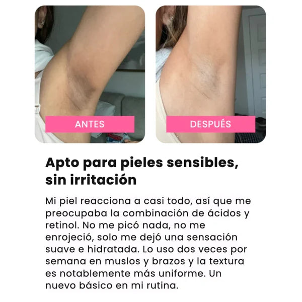 Kojilux™ – Spray Exfoliante con Ácido Kójico 99% – Elimina Manchas y Zonas Oscuras