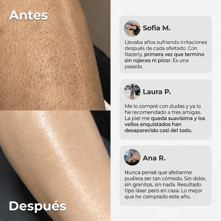 Silkéa™ – Piel Suave. Cero Cortes. Cero Irritación