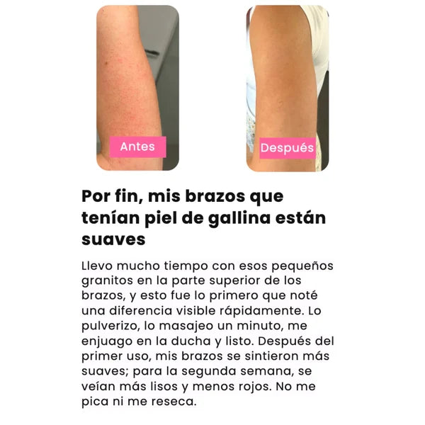Kojilux™ – Spray Exfoliante con Ácido Kójico 99% – Elimina Manchas y Zonas Oscuras
